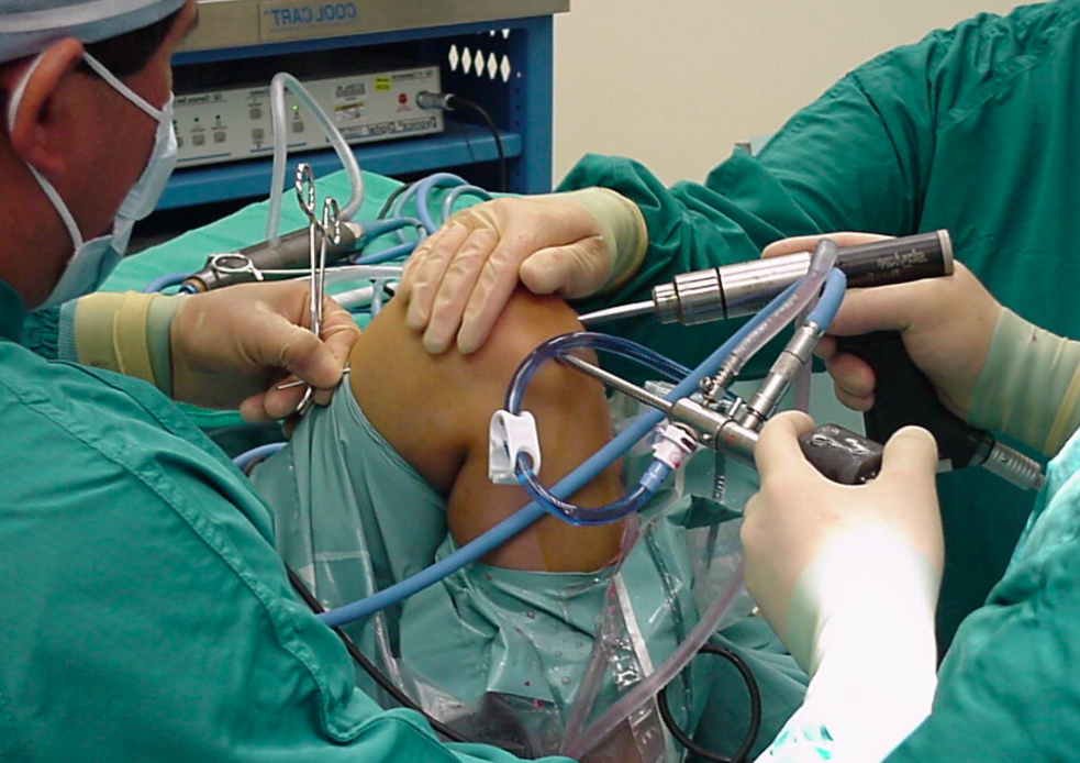 Phẫu thuật nội soi để tái tạo dây chằng chéo trước cho bệnh nhân